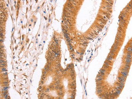 TAX1BP1 Polyclonal Antibody Store at -20°C - MSE Supplies LLC
