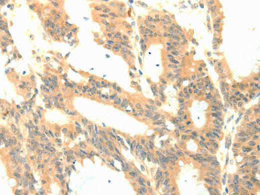 P23 Polyclonal Antibody Store at -20°C - MSE Supplies LLC