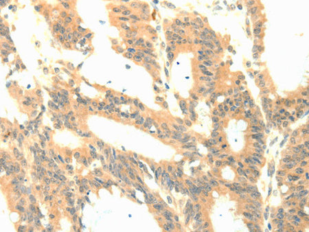 P23 Polyclonal Antibody Store at -20°C - MSE Supplies LLC