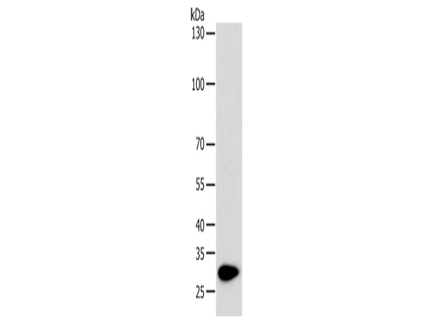 TPM1 Polyclonal Antibody Store at -20°C - MSE Supplies LLC