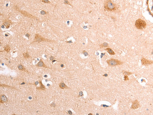 TRPV4 Polyclonal Antibody Store at -20°C - MSE Supplies LLC