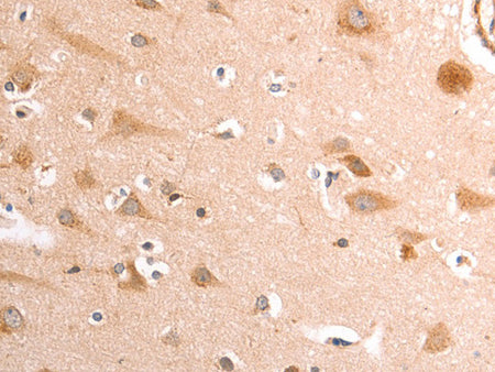 TRPV4 Polyclonal Antibody Store at -20°C - MSE Supplies LLC