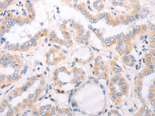CIDEB Polyclonal Antibody Store at -20°C - MSE Supplies LLC