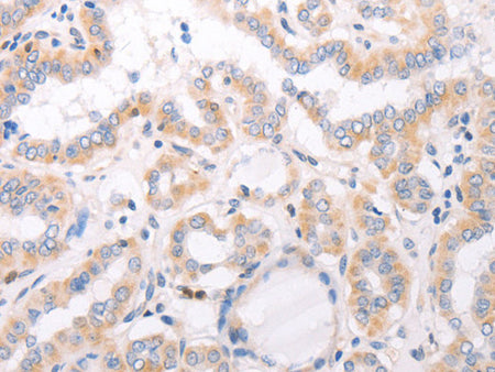 CIDEB Polyclonal Antibody Store at -20°C - MSE Supplies LLC