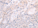 TSHR Polyclonal Antibody Store at -20°C - MSE Supplies LLC