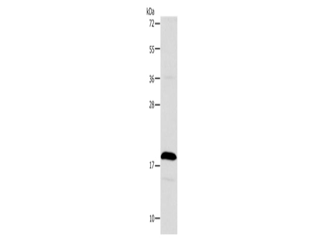 TSLP Polyclonal Antibody Store at -20°C - MSE Supplies LLC