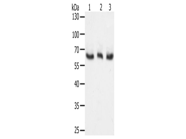 TYR Polyclonal Antibody Store at -20°C - MSE Supplies LLC