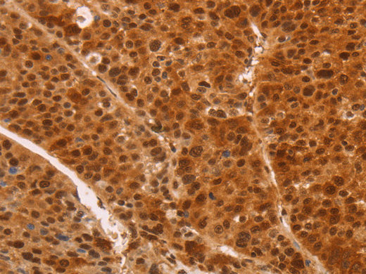 HEXIM1 Polyclonal Antibody Store at -20°C - MSE Supplies LLC
