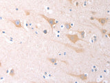 SCGB1A1 Polyclonal Antibody Store at -20°C - MSE Supplies LLC