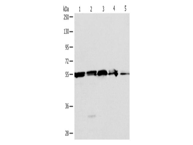 NAMPT Polyclonal Antibody Store at -20°C - MSE Supplies LLC
