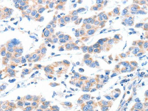 XBP1 Polyclonal Antibody Store at -20°C - MSE Supplies LLC