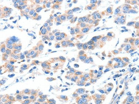 XBP1 Polyclonal Antibody Store at -20°C - MSE Supplies LLC