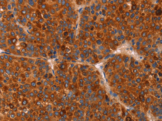GC Polyclonal Antibody Store at -20°C - MSE Supplies LLC
