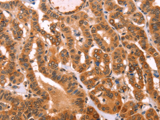 PROS1 Polyclonal Antibody Store at -20°C - MSE Supplies LLC