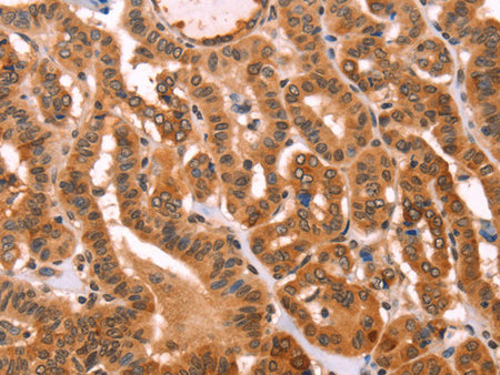 PROS1 Polyclonal Antibody Store at -20°C - MSE Supplies LLC
