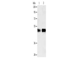 SERPINA5 Polyclonal Antibody Store at -20°C - MSE Supplies LLC