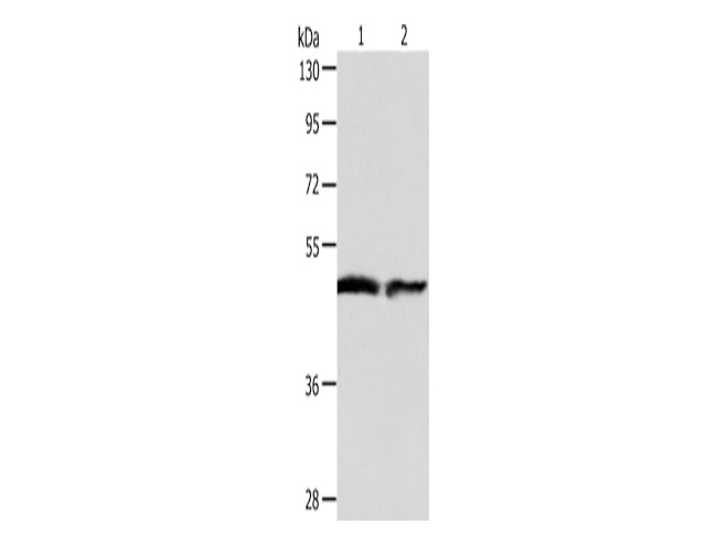 AADAC Polyclonal Antibody Store at -20°C - MSE Supplies LLC