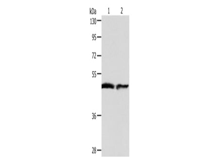 AADAC Polyclonal Antibody Store at -20°C - MSE Supplies LLC