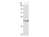 NCEH1 Polyclonal Antibody Store at -20°C - MSE Supplies LLC