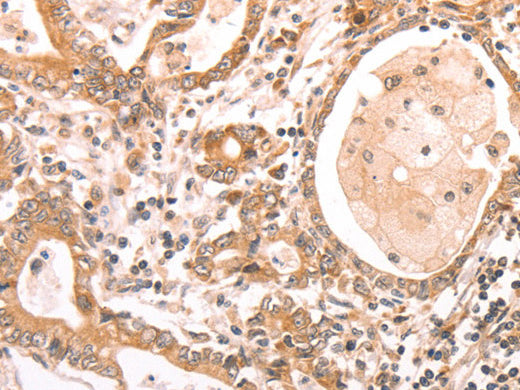 ABCF1 Polyclonal Antibody Store at -20°C - MSE Supplies LLC