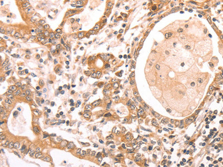 ABCF1 Polyclonal Antibody Store at -20°C - MSE Supplies LLC
