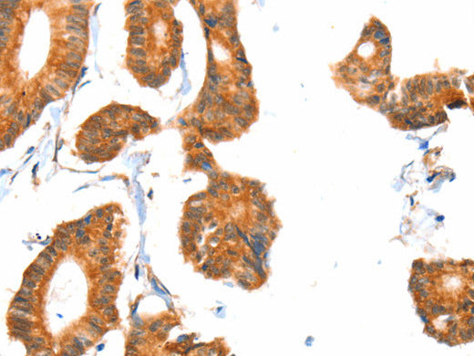 ACOX1 Polyclonal Antibody Store at -20°C - MSE Supplies LLC