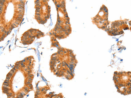 ACOX1 Polyclonal Antibody Store at -20°C - MSE Supplies LLC