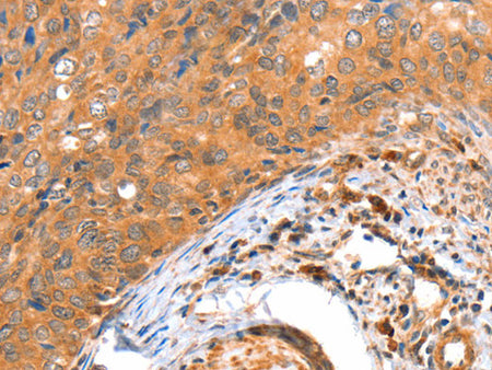 ACOX3 Polyclonal Antibody Store at -20°C - MSE Supplies LLC