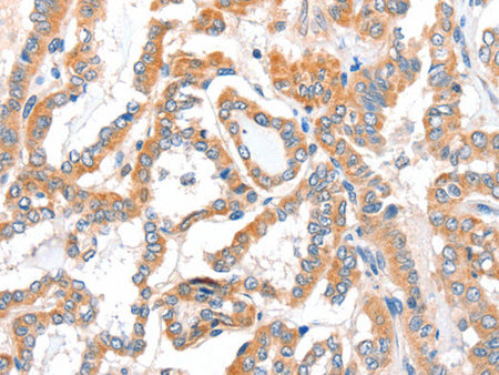 ACSBG1 Polyclonal Antibody Store at -20°C - MSE Supplies LLC