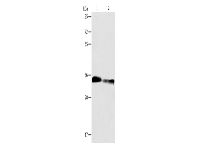 ACY3 Polyclonal Antibody Store at -20°C - MSE Supplies LLC