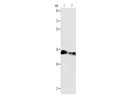 ACY3 Polyclonal Antibody Store at -20°C - MSE Supplies LLC