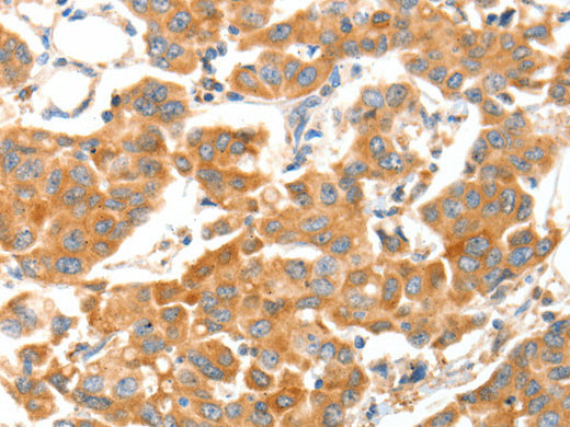 ADAMTS18 Polyclonal Antibody Store at -20°C - MSE Supplies LLC