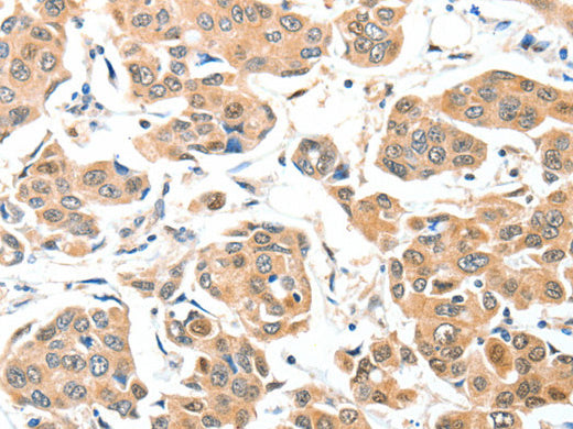 ADCK1 Polyclonal Antibody Store at -20°C - MSE Supplies LLC