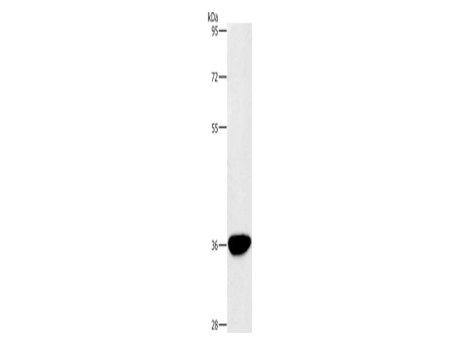 AKR1D1 Polyclonal Antibody Store at -20°C - MSE Supplies LLC