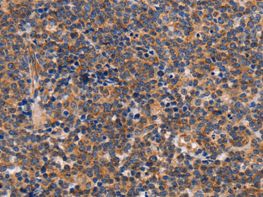 ALG9 Polyclonal Antibody Store at -20°C - MSE Supplies LLC