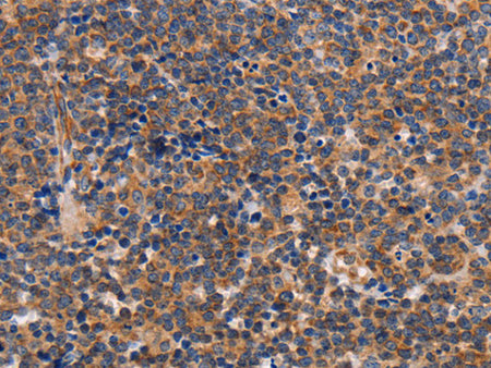 ALG9 Polyclonal Antibody Store at -20°C - MSE Supplies LLC