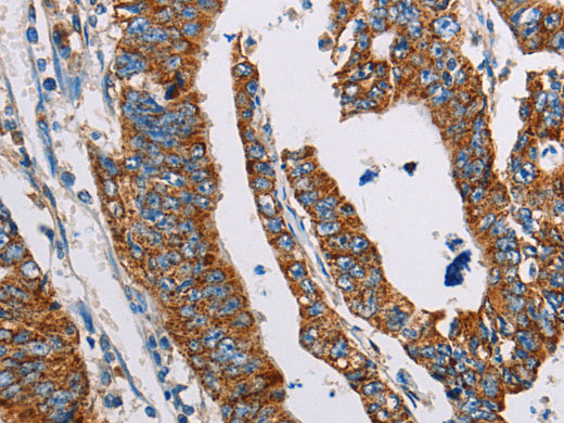 ALG2 Polyclonal Antibody Store at -20°C - MSE Supplies LLC