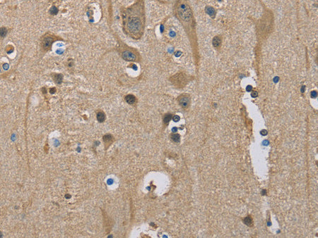 SERPINA1 Polyclonal Antibody Store at -20°C - MSE Supplies LLC