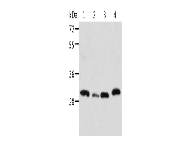 STRADB Polyclonal Antibody Store at -20°C - MSE Supplies LLC