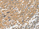 ANGPTL7 Polyclonal Antibody Store at -20°C - MSE Supplies LLC