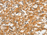 ANKMY2 Polyclonal Antibody Store at -20°C - MSE Supplies LLC