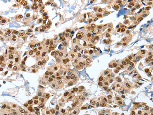 ANXA10 Polyclonal Antibody Store at -20°C - MSE Supplies LLC