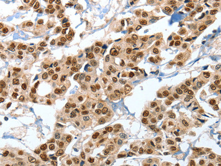 ANXA10 Polyclonal Antibody Store at -20°C - MSE Supplies LLC