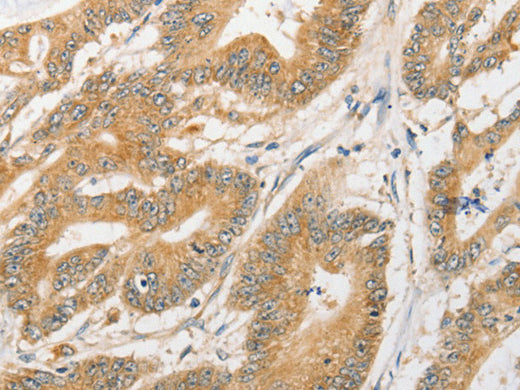 ATG5 Polyclonal Antibody Store at -20°C - MSE Supplies LLC