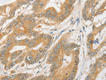 ATG5 Polyclonal Antibody Store at -20°C - MSE Supplies LLC