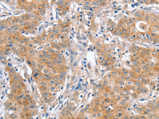 ATG12 Polyclonal Antibody Store at -20°C - MSE Supplies LLC