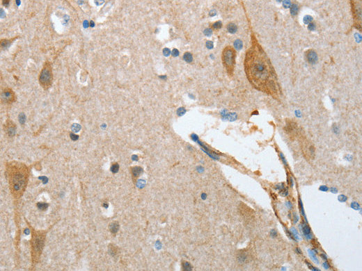 NOL3 Polyclonal Antibody Store at -20°C - MSE Supplies LLC