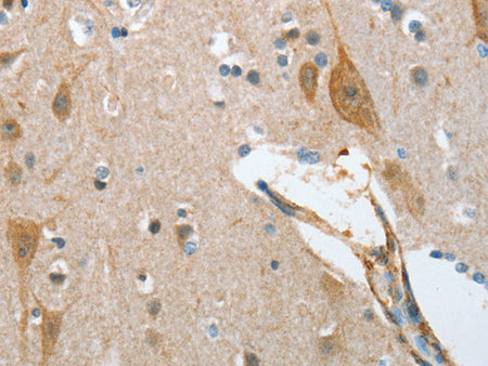 NOL3 Polyclonal Antibody Store at -20°C - MSE Supplies LLC