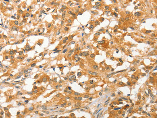 APTX Polyclonal Antibody Store at -20°C - MSE Supplies LLC