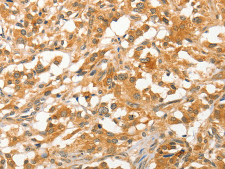 APTX Polyclonal Antibody Store at -20°C - MSE Supplies LLC